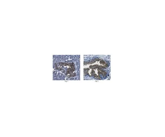 62-8458-10 Anti-ATP-citrate synthase / ACLY ABC426