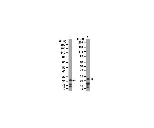 62-8387-08 Anti-Chromobox protein homolog 7 (Cbx7); 100 μg 07-981