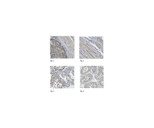 62-8457-38 Anti-Death-associated protein 1 Antibody Cat. No. ABC259 ABC259