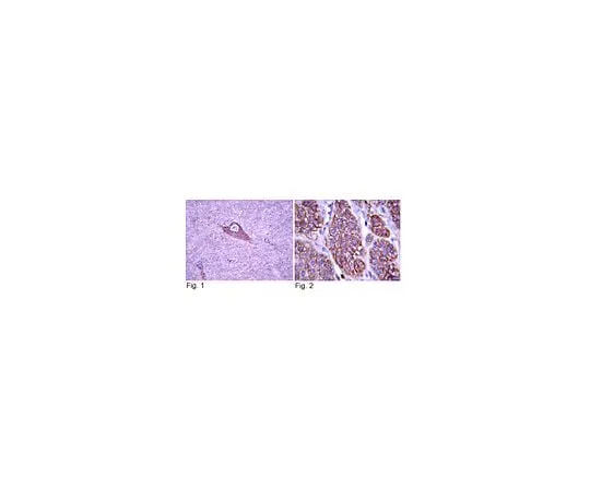 62-8381-69 Anti-TrkA; 200 μg 06-574