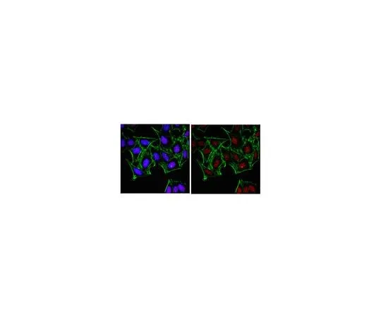 62-8389-98 Anti-JMJD1C; 100 μg 09-817