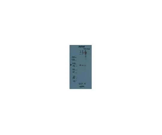 62-8453-80 Anti-STIM1; 100 μg AB9870