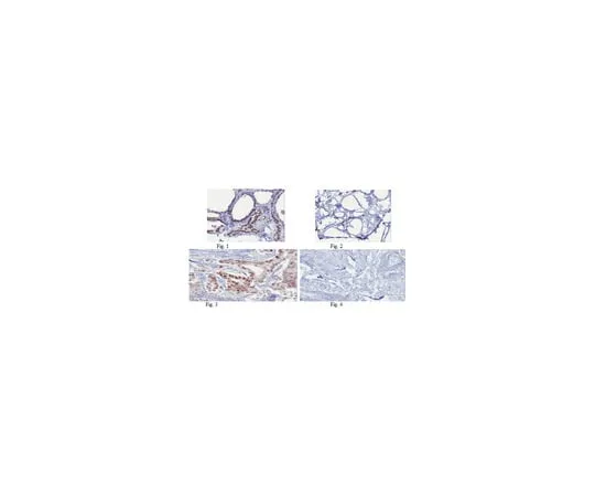 62-8375-43 Anti-FOXO3a/FKHRL1, clone 15F7.2; 100 μg 05-1587