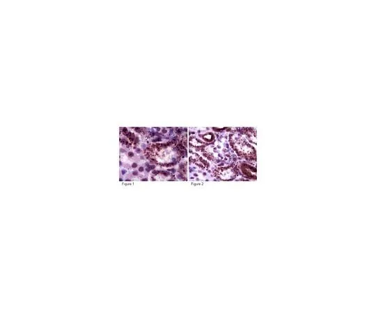 62-8460-60 Anti-Sirt5; 100 μg ABE198