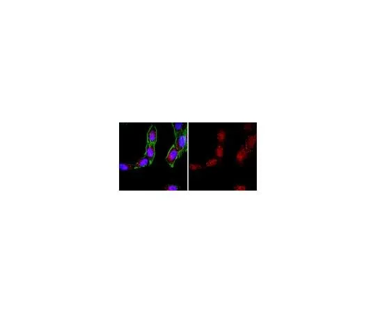 62-8456-32 Anti-Bak (N-terminus); 100 μg ABC12