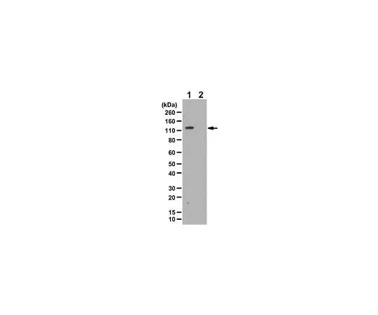 62-8456-80 Anti-phospho-ULK1/ATG1 (Ser758); 100 μL ABC112
