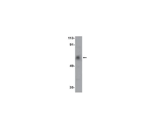 62-8467-44 Anti-ACVR1C ABN476