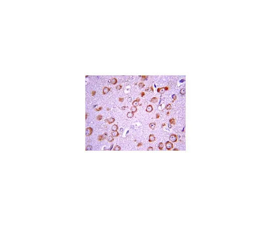 62-8374-34 Anti-Focal Adhesion Kinase, clone BLAb2H7; 100 μg 05-1139