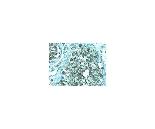 62-8446-67 Anti-ZO-1; 100 μg AB2272