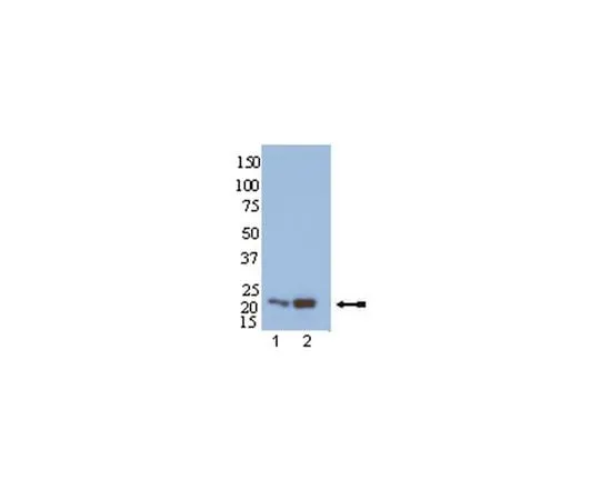62-8386-99 Anti-Rap1; 100 μL 07-916