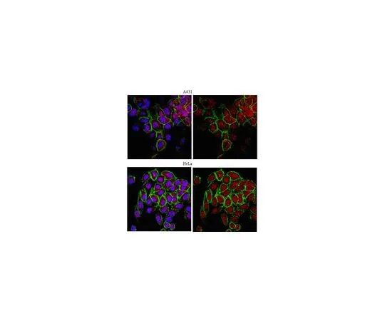 62-8460-19 Anti-ERR-alpha; 100 μg ABE64