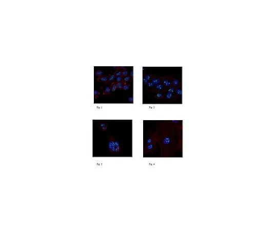 62-8462-86 Anti-Ligand-dependent nuclear receptor-interacting factor 1 ABE1008