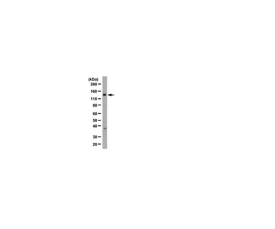 62-8387-13 Anti-Upf1; 100 μL 07-1014