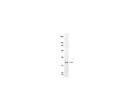 62-8381-21 Anti-Gβ; 50 μL 06-238