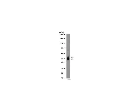62-8452-27 Anti-MMP-12, N-term (active); 100 μg AB6010