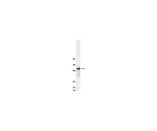 62-8381-14 Anti-Lyn; 250 μL 06-207