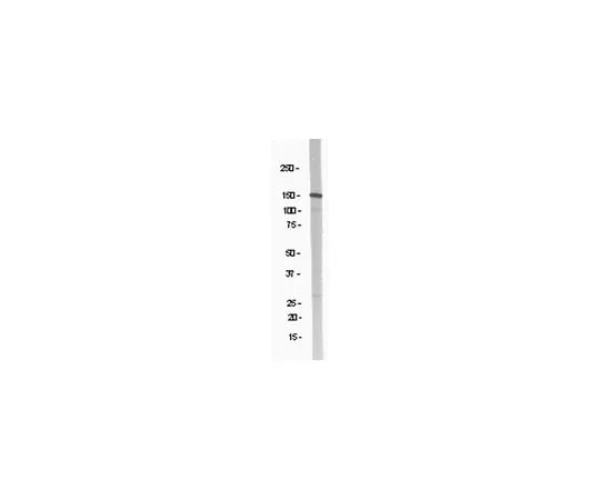 62-8381-79 Anti-NR2B; 250 μg 06-600