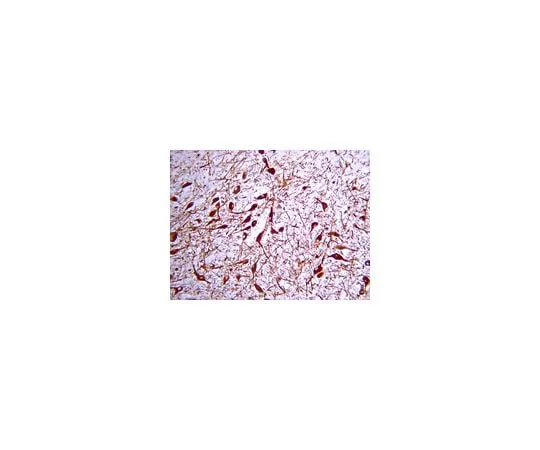 62-8444-33 Anti-Tyrosine Hydroxylase; 100 μL AB152