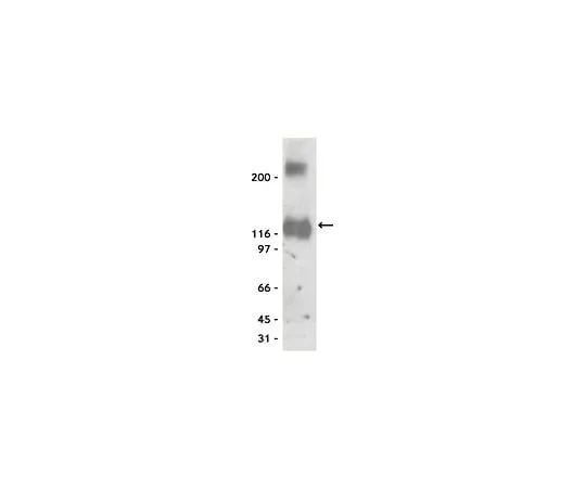 62-8385-03 Anti-K+/Cl- Cotransporter (KCC2); 100 μg 07-432
