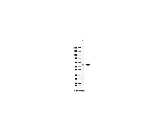 62-8459-35 Anti-Aldehyde dehydrogenase 1 (ALDH1A1); 100 μg ABD12