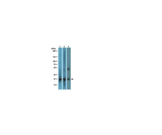62-8367-86 anti-RalB, clone 25; 100 μg 04-037