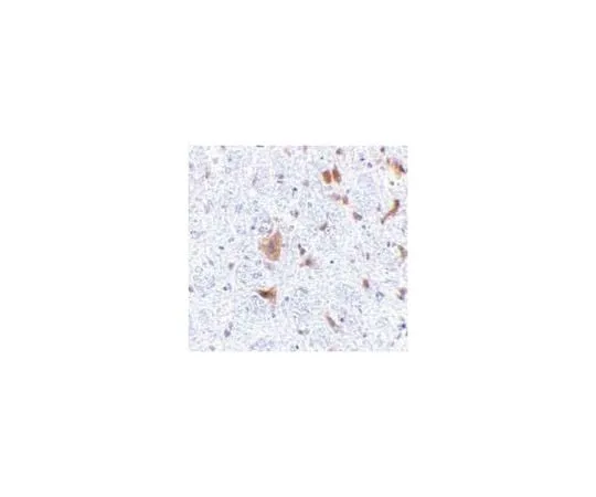 62-8467-46 Anti-LFG ABN478