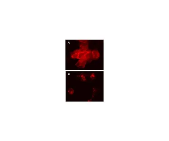 62-8394-49 LentiBrite(TM) RFP-β-actin Lentiviral Biosensor 17-10203