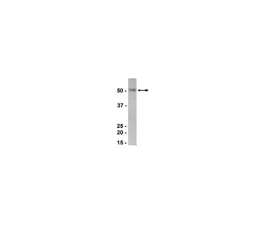 62-8386-13 Anti-Estrogen-related Receptor α; 100 μg 07-662