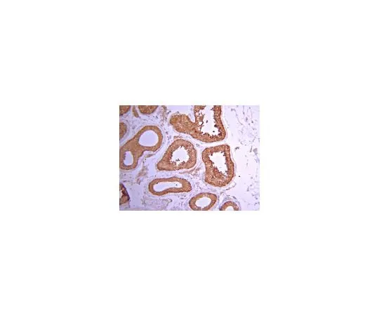 62-8387-24 Anti-PP6C; 100 μg 07-1224