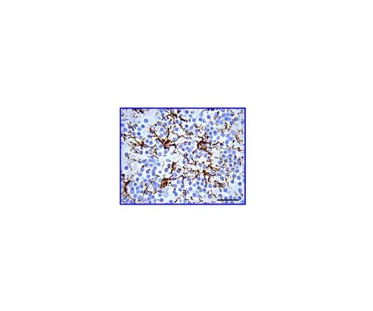 62-8451-53 Anti-Glial Fibrillary Acidic Protein (GFAP); 50 μL AB5804