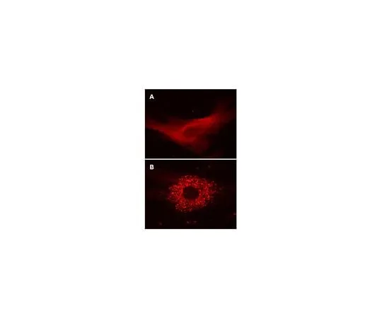 62-8394-31 LentiBrite(TM) RFP-LC3 Lentiviral Biosensor 17-10143