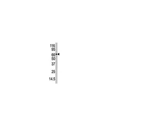 62-8389-91 Anti-PADI4, C-terminus; 100 μg 09-796