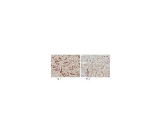 62-8465-76 Anti-Vesicular Acetylcholine Transporter (VAChT) ABN100