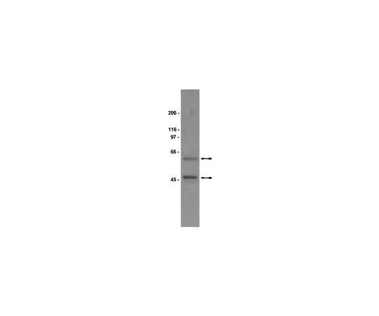 62-8381-20 Anti-Gsα; 50 μL 06-237