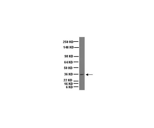 62-8452-12 Anti-Musashi-1; 100 μg AB5977