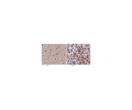 62-8466-54 Anti-SAPAP1 ABN309