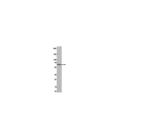 62-8368-77 Anti-Estrogen Receptor β, clone 68-4; 100 μL 04-824