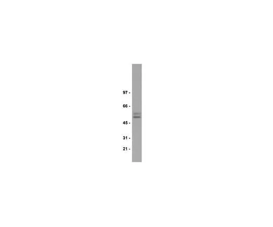 62-8384-87 Anti-Smad2/3; 200 μL 07-408