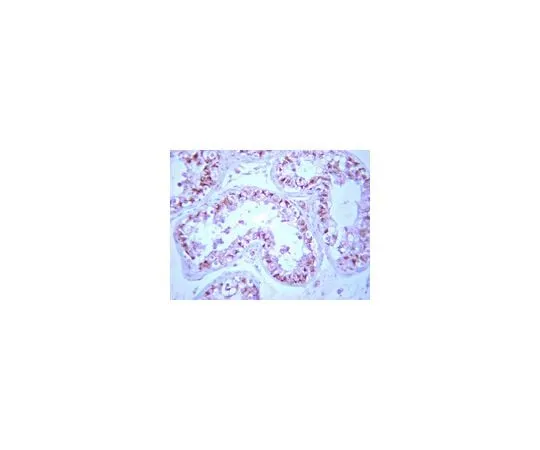 62-8387-21 Anti-PP2A, B β subunit;; 100 μg 07-1219