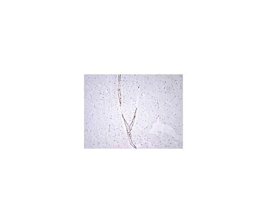 62-8452-50 Anti-von Willibrand Factor; 100 μg AB7356
