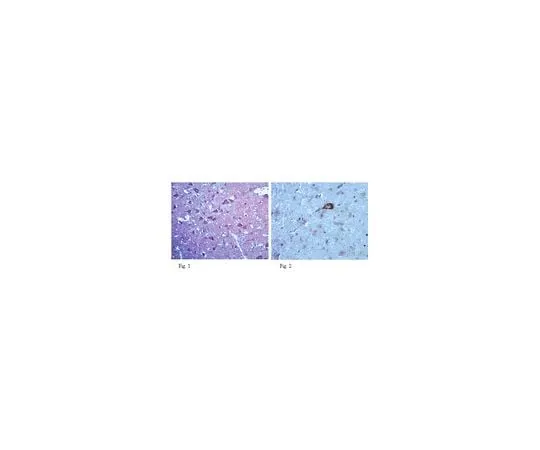 62-8465-72 Anti-Neurexin3; 100 μg ABN96