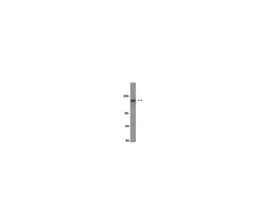 62-8371-82 Anti-CFTR, clone M3A7; 200 μg 05-583