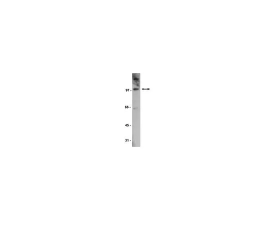 62-8385-30 Anti-Daxx; 200 μL 07-471