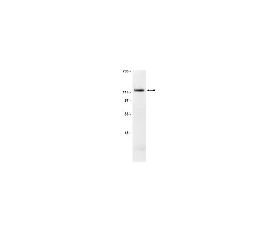 62-8370-56 Anti-FAK, clone 2A7; 200 μg 05-182