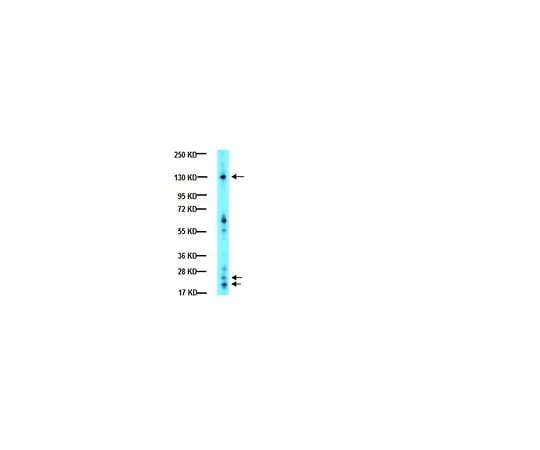 62-8446-06 Anti-Integrin alphaV, C-terminus, Intracellular; 100 μL AB1930