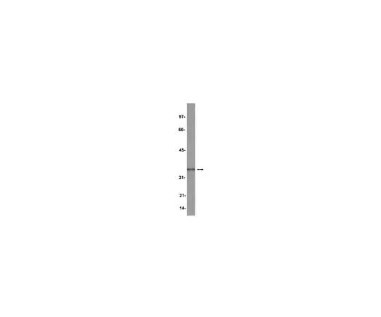 62-8383-93 Anti-Hox A9; 200 μg 07-178