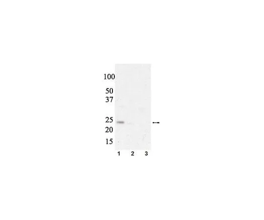 62-8386-74 anti-phospho eIF4E (Ser209); 100 μL 07-823