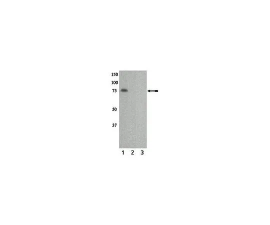 62-8386-90 anti-phospho-PKCη (Thr655); 100 μL 07-877