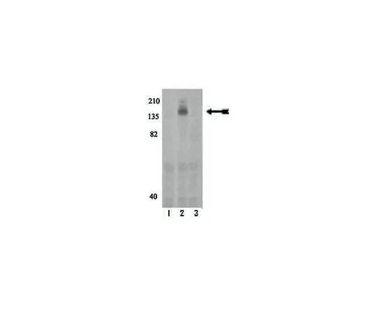 62-8386-66 Anti-phospho-c-Kit (Tyr568/Tyr570); 100 μL 07-806
