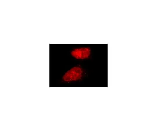 62-8394-59 LentiBrite(TM) RFP-Rad51 Lentiviral Biosensor 17-10220